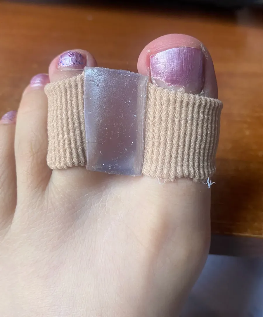 Gel toe spacers photographed by Priya S., a verified buyer